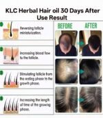 KLC Mart Herbal Hair Oil with Bhringraj, Amla & Onion – Natural Hair Growth & Strengthening Oil (200ml) - Image 3